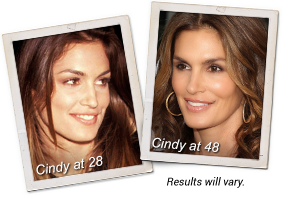 cindy-before-and-after-mb5
